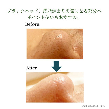〈気になる毛穴づまりに〉メリッサボーテ　アミノクレンジングジェル